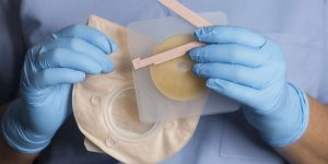 Stoma Beutel und Platte