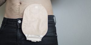 Stoma Beutel