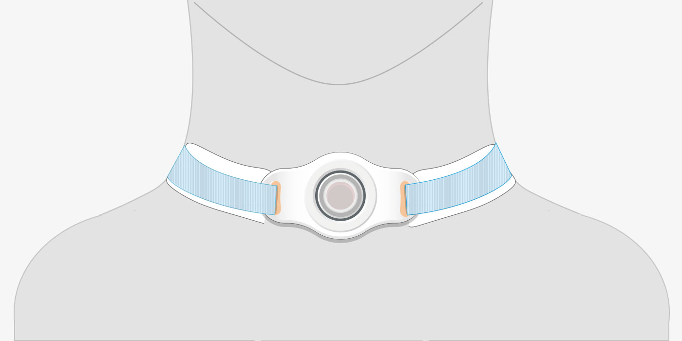 Tracheo Illustration