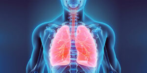 Pneumonien